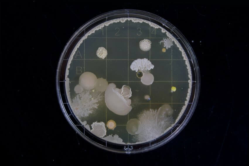 Different Types of Habitats Around the World 12 Microorganism