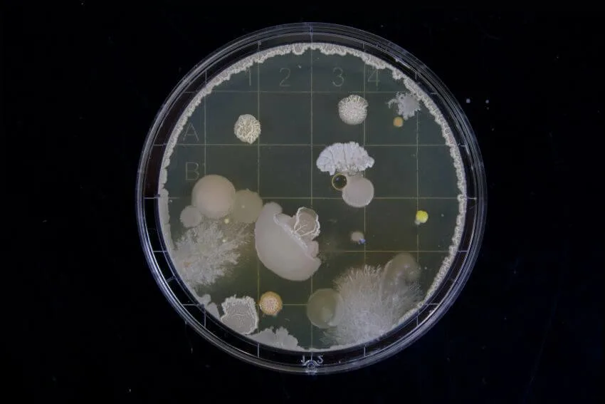 16 Different Types of Habitats Around the World 12 Microorganism