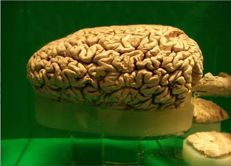 Sperm Whale Brain