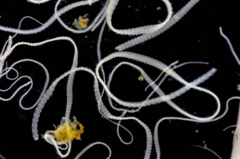 Tapeworm Tapeworm under the microscope